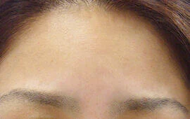 画像引用元:オザキクリニック (218)