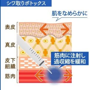 画像引用元:オザキクリニック (380)